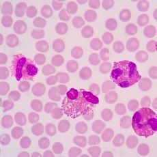 Eosinophilia: Definition, Symptoms, Causes and Treatment